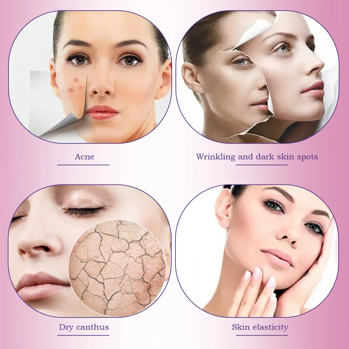 Vaporizador Facial